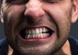 Grinding Teeth Anxiety