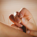 Benefits of acupuncture for everyone